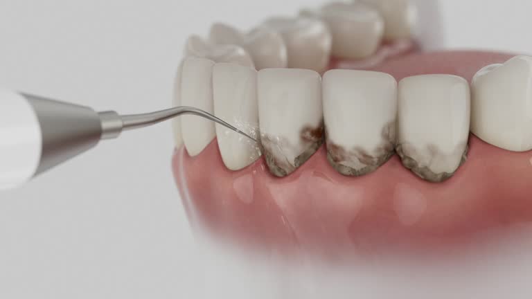 Reliable Dental contractor in Sky Valley, CA by Smile Center Dentistry